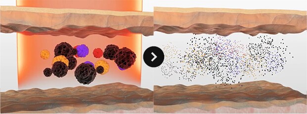 Picosecond Laser