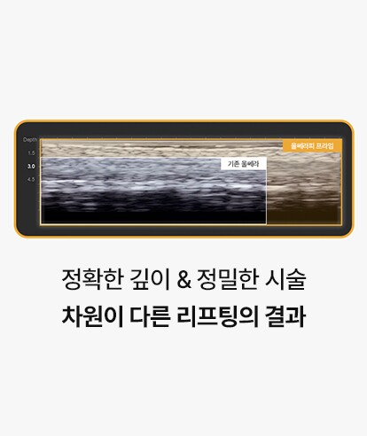 Clear Ultrasound Images Up to 8mm Deep
