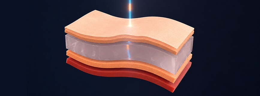 2910nm Ultra-Fast Laser