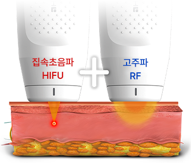 FL · SD handpieces